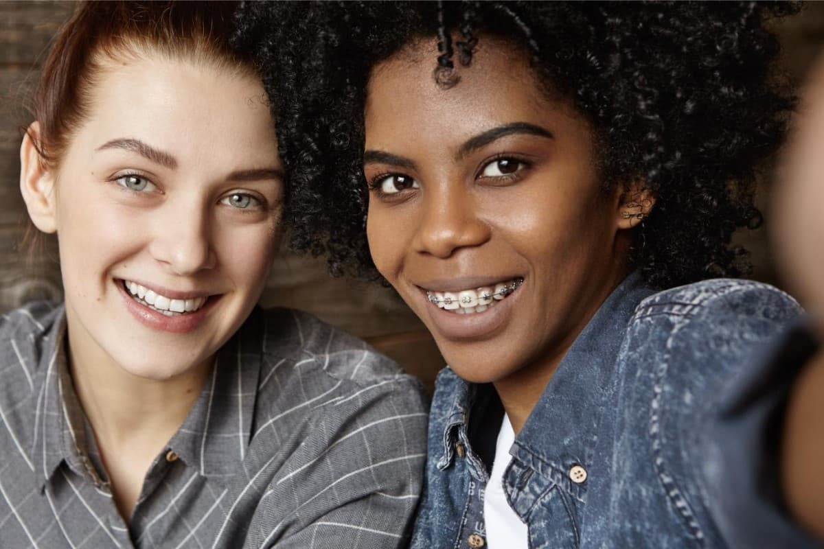 Seacoast Braces / Miller Orthodontics Exclusive Provider of Dynaflex Norris Brackets in Dover and Exeter, NH